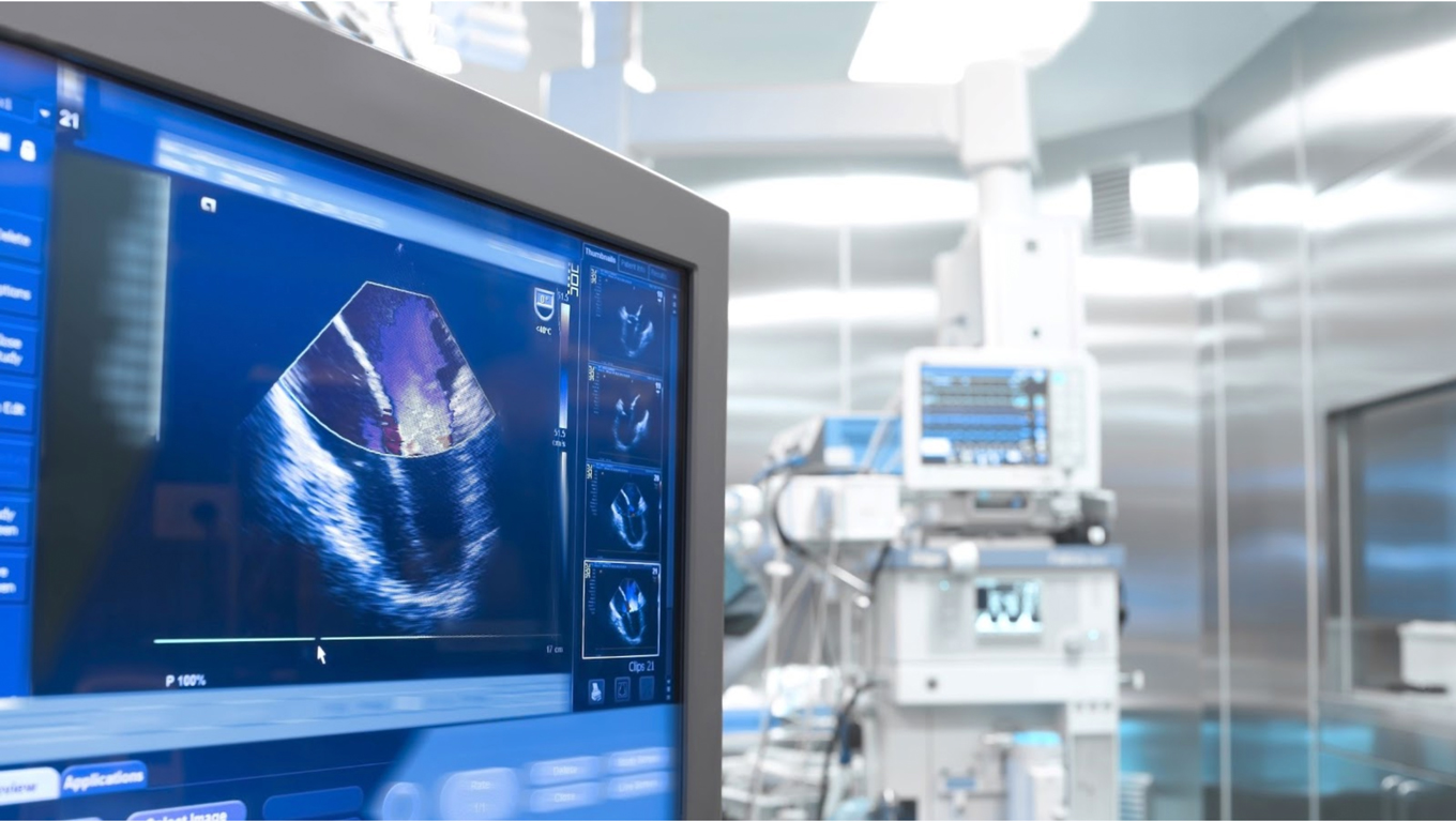 Echocardiography machine displaying images in a hospital