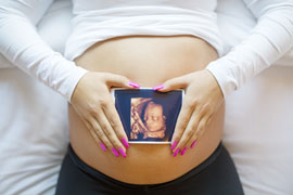 How 3D and 4D Ultrasound is Changing OB/GYN